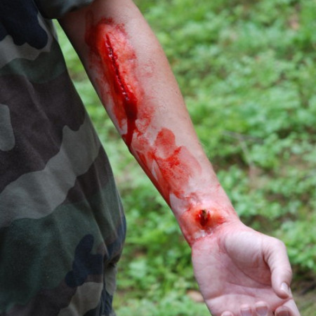 [kurz-prvni-pomoci-9-resize.jpeg]